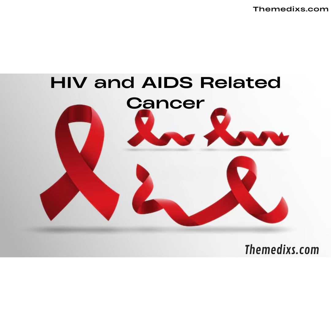 HIV and AIDS Related Cancer