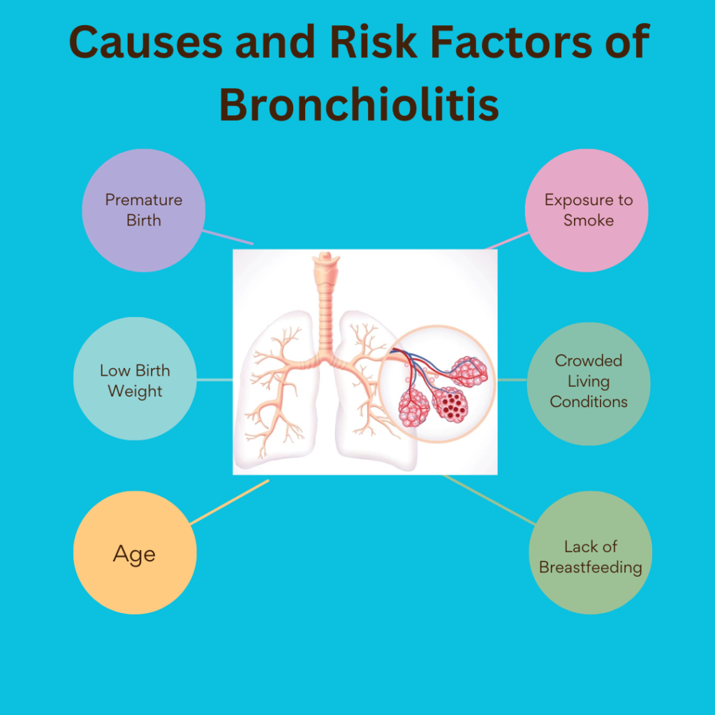 Bronchiolitis