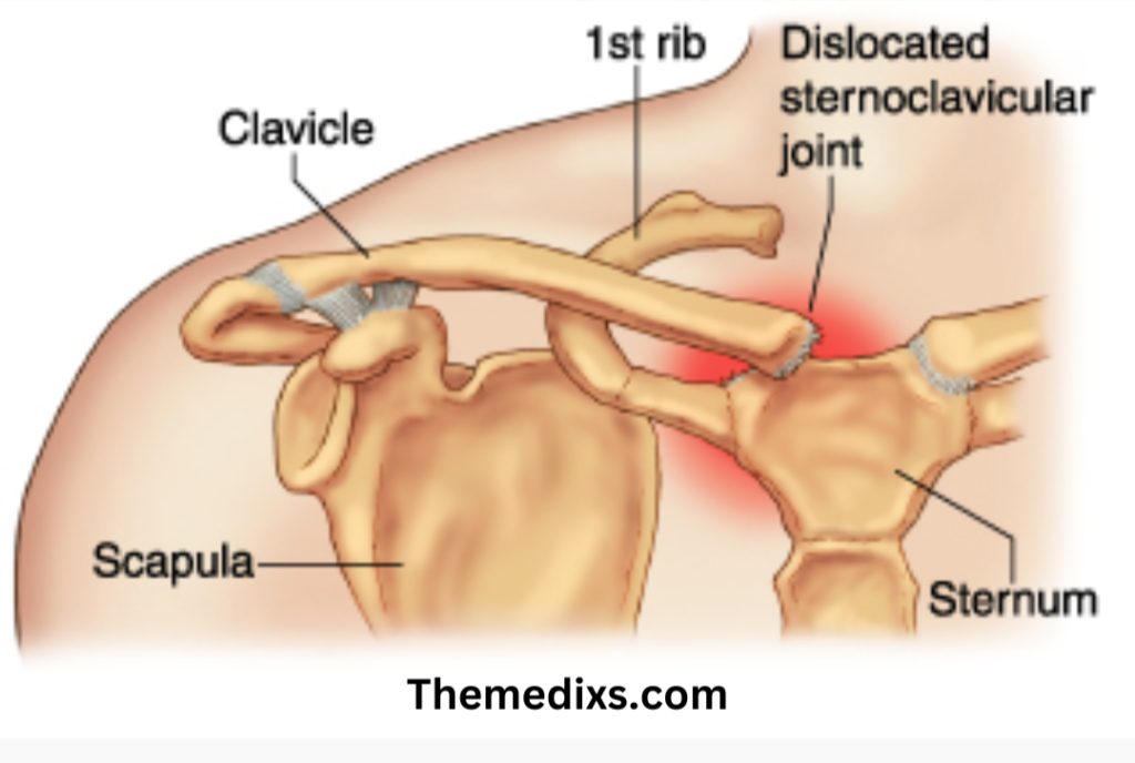 Sternoclavicular (SC Joint)